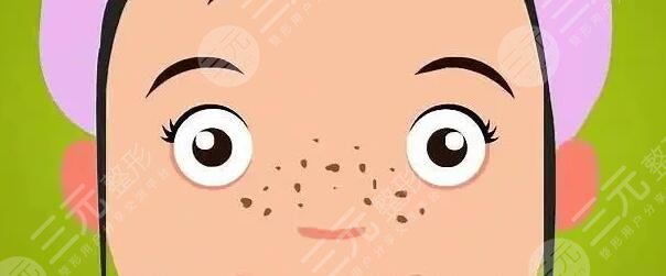 美白祛斑小竅門有哪些?