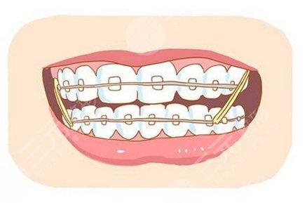 北京世紀(jì)壇醫(yī)院牙齒矯正專家