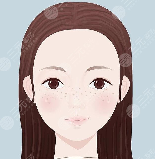 臉上長(zhǎng)斑怎么去除有效?