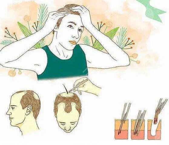 頭發(fā)種植能保持多久時(shí)間?