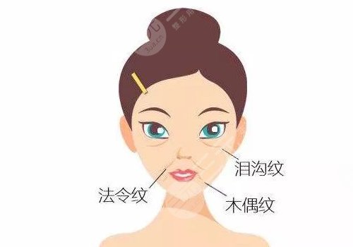 法令紋太深了有什么解決辦法？