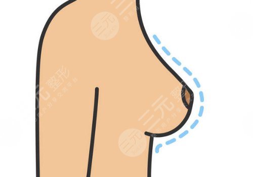 奧美定取出手術(shù)后要注意些什么？