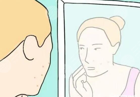 怎么快速祛痘痘印不傷膚又有效？分享明星們都在用的幾個小妙招，簡單易上手！