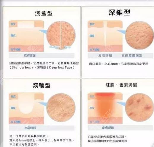 激光美白能夠維持多久?