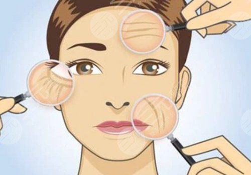 如何去除抬頭紋？