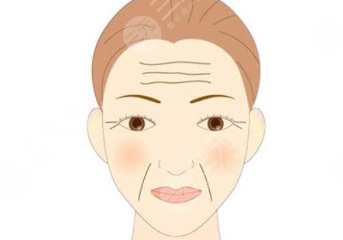 如何去除抬頭紋？