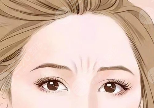 玻尿酸填充法令紋有危害嗎？