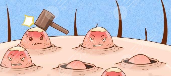 快速祛痘小竅門有哪些？外防內(nèi)治讓效果更徹底！找對長痘根源才是關(guān)鍵！