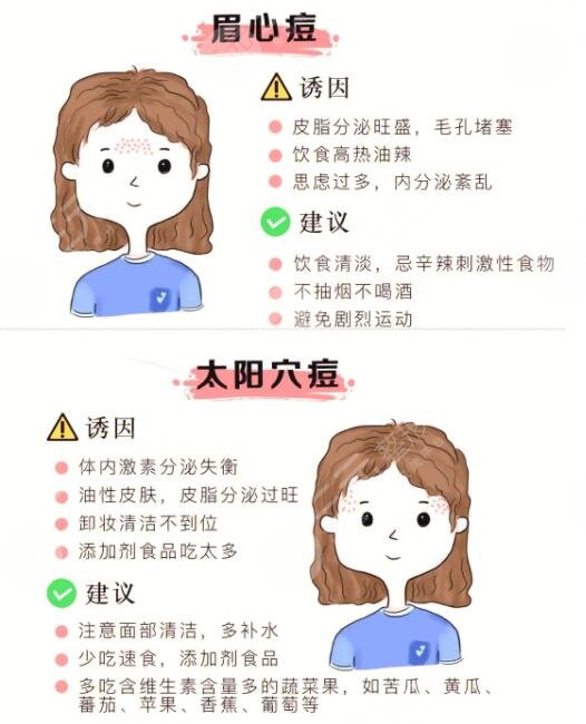 快速祛痘小竅門有哪些?