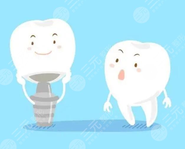 種牙材質(zhì)都有哪些品牌好?