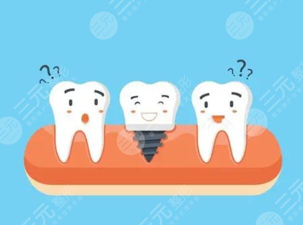 種牙材質(zhì)都有哪些品牌好?