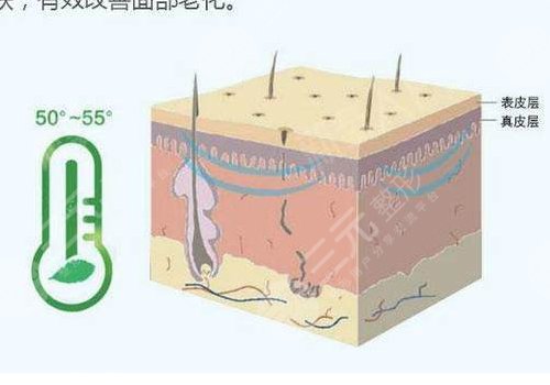 深藍(lán)射頻做一次有效果嗎？