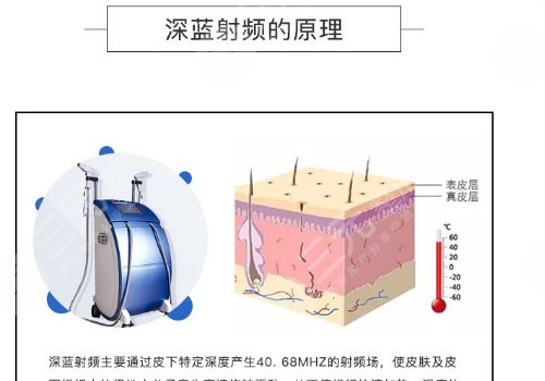 深藍(lán)射頻和熱拉提哪個(gè)好？