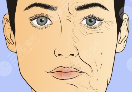 深藍(lán)射頻和熱拉提哪個(gè)好？