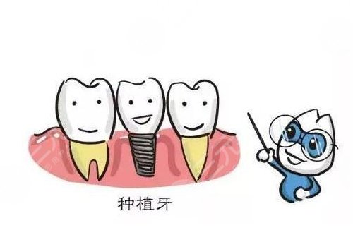 種植牙可以用社保卡報銷嗎？