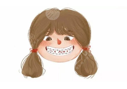 種植牙齒的壽命多少年？