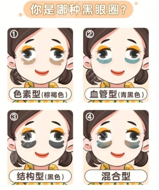 黑眼圈很重怎么去除見效快?