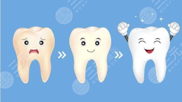 冷光美白牙齒好不好?