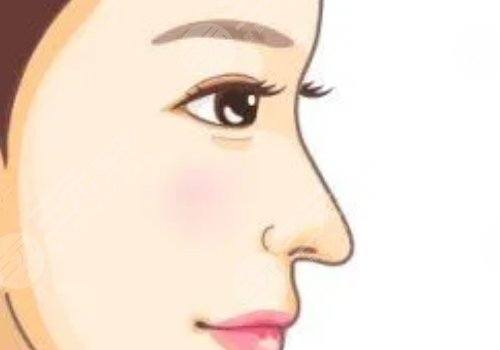 膠原蛋白隆鼻會(huì)變寬嗎？