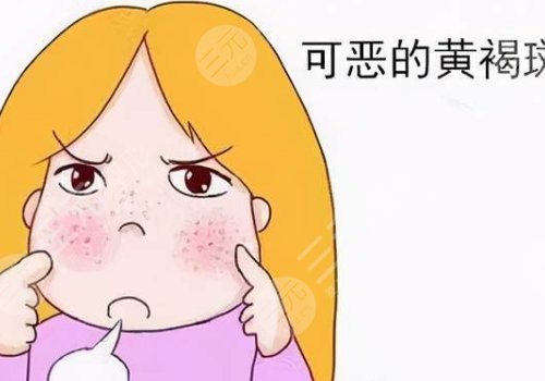 光子嫩膚祛斑會(huì)反彈嗎