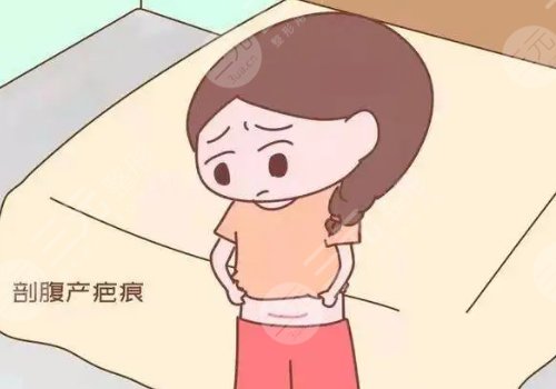 激光去疤痕需要幾次才能徹底消除？