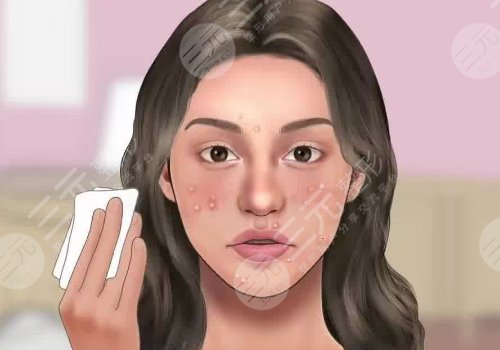 去黑頭收縮毛孔好的方法有哪些？