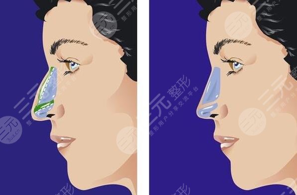 俞積貴醫(yī)生擅長項目介紹