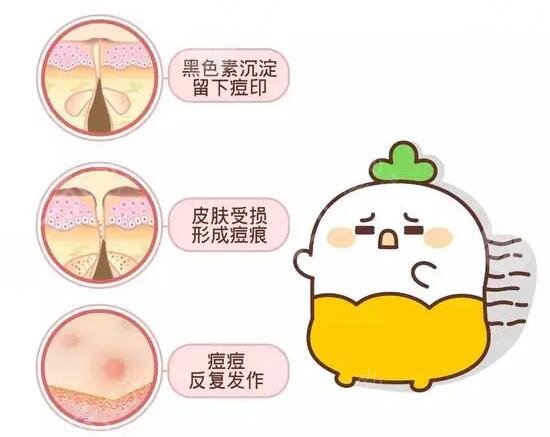 激光緩解青春痘的效果如何?