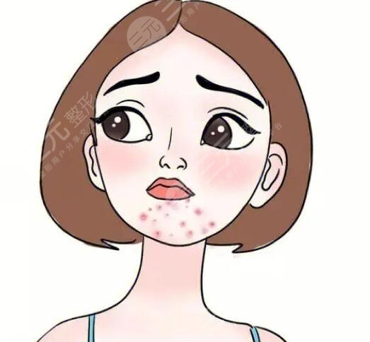 　　很多人經(jīng)常在下巴處會長一些痘痘，有的人認(rèn)為長痘痘的原因是和自己的內(nèi)分泌有關(guān)系，也有的女性朋友認(rèn)為自己的長痘問題和自己的護(hù)膚存在一定的關(guān)系，所以說在面對自己的痘痘時(shí)，一定要充分地了解自己長痘的類型，這樣才能夠改良痘痘使痘痘消除，所以說想豆豆和我們的身體健康存在一定關(guān)系的，大家不但要調(diào)整自己的作息習(xí)慣，同時(shí)也要有正確的護(hù)膚流程，一起來了解下吧，長痘的是哪里的問題?  　　下巴長痘痘是哪里的問題?  　　1、飲食問題  　　下巴長痘痘根據(jù)飲食有著一定的關(guān)系，所以說如果我們長期飲食不規(guī)律，在體內(nèi)的毒素長期積累，從而會影響我們的皮膚狀態(tài)產(chǎn)生一些皮膚問題，例如長痘痘長色斑等，建議大家在飲食方面堅(jiān)持以清淡健康的飲食為主，也要少吃一些辛辣刺激性的食物，這樣才可以很好地改良肌膚，也要養(yǎng)成良好的作息習(xí)慣，可以早睡早起經(jīng)常參加一些鍛煉，也能夠減少痘痘的產(chǎn)生，同時(shí)也要戒煙戒酒，把這些壞習(xí)慣都改掉之后，配合飲食配合作息，就可以改良痘痘。  　　2、激素失衡問題  　　有一些人群下巴長痘痘的原因和自己體內(nèi)激素分泌有一定的關(guān)系，所以說如果激素失衡，也會在下巴處長一些痘痘，比如說女性朋友在來月經(jīng)之前，身體內(nèi)的激素會處于一個(gè)不平衡的狀態(tài)，會間接引起皮脂腺分泌旺盛，從而在下巴處長出一些痘痘，如果是這種情況，建議大家一定要放松心情，從而改良睡眠質(zhì)量，減輕壓力，才可以很好地度過這個(gè)時(shí)期，但是這種痘痘往往在月經(jīng)過后就會恢復(fù)到一個(gè)正常的皮膚狀態(tài)，不用過分的擔(dān)心。  　　3、內(nèi)分泌失調(diào)  　　內(nèi)分泌失調(diào)也會導(dǎo)致痘痘的產(chǎn)生，所以說在失調(diào)的過程當(dāng)中會使皮脂腺分泌得過于旺盛，由于油脂分泌的較多，不能夠及時(shí)清潔，很容易堵塞毛孔，產(chǎn)生一些油膩的痘痘，這時(shí)候一定要調(diào)節(jié)自己的內(nèi)分泌，改良自己的睡眠，才可以改良痘痘，也可以服用一些中藥來進(jìn)行改良。  　　4、體內(nèi)毒素堆積過多  　　如果我們經(jīng)常吃一些比較油膩的食物，會引起消化方面的問題，所以說在體內(nèi)會堆積過多的毒素，從而使毒素沒有辦法排出，導(dǎo)致痘痘的產(chǎn)生，如果是體內(nèi)毒素堆積過多，首先長痘的部位就是下巴處，這時(shí)候人們的肝臟排毒功能也逐漸下降，一定要積極地調(diào)整飲食，健康的作息才可以得到根本的改變，這時(shí)候可以吃一些比較常見的排毒養(yǎng)顏膠囊，也可以在專業(yè)的醫(yī)生指導(dǎo)下吃一些中藥。  　　5、青春痘  　　很多人在青春期的時(shí)候會長一些痘痘，這么也是大家所說的，青春痘在長痘的過程當(dāng)中還會伴隨局部疼痛紅腫等問題，一定要積極地尋找醫(yī)生的緩解，可以選用激光緩解痘痘。