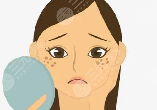 激光祛斑會不會反彈？需要做幾次？