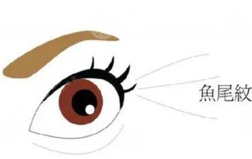 魚尾紋