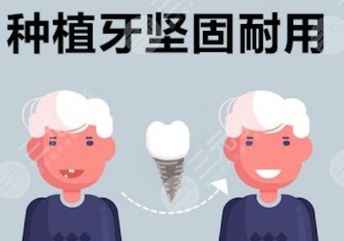 種植牙瑞士瑞典哪個好？