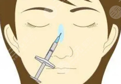 艾莉薇傳奇玻尿酸維持多久？