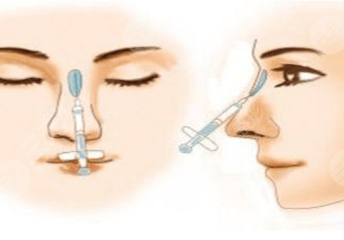 艾莉薇傳奇玻尿酸維持多久？