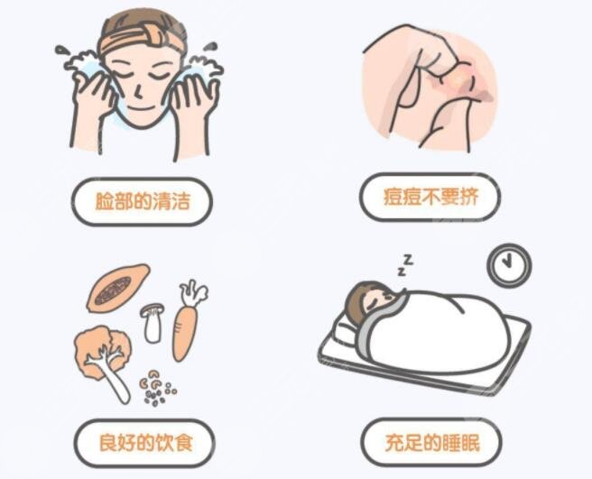 激光祛痘原理是什么?