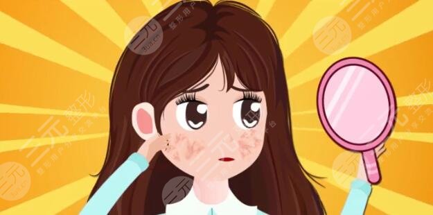 激光嫩膚價格是多少?