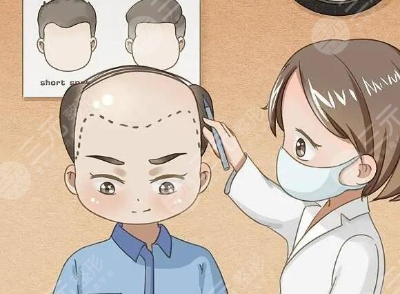 脫發(fā)護理注意事項