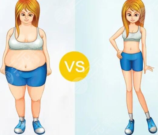 溶脂減肥手術(shù)優(yōu)點(diǎn)