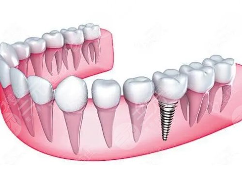 成都畫美團(tuán)圓口腔醫(yī)院醫(yī)生介紹