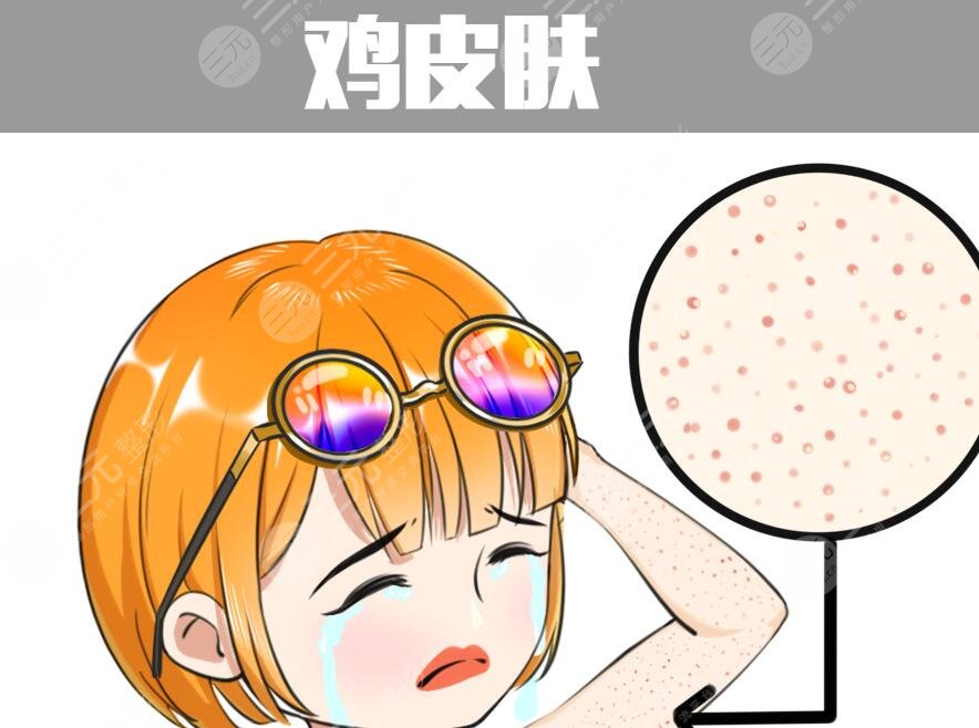 雞皮疙瘩皮膚怎么治見(jiàn)效快？預(yù)防和根治雙重入手，避免反復(fù)發(fā)作！