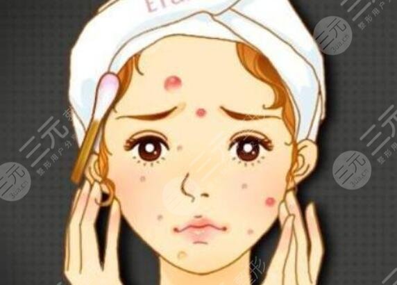 淡化紅色痘印的護膚品