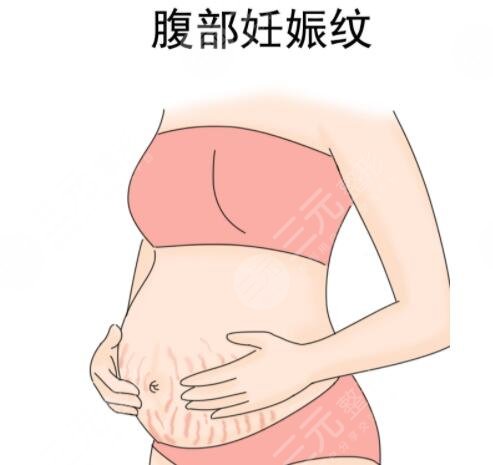 橄欖油其他作用