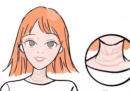 頸紋怎么消除?