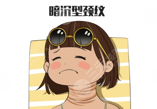 頸紋怎么消除?