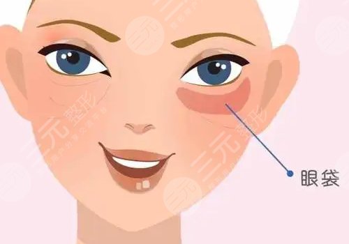眼袋怎么消除？