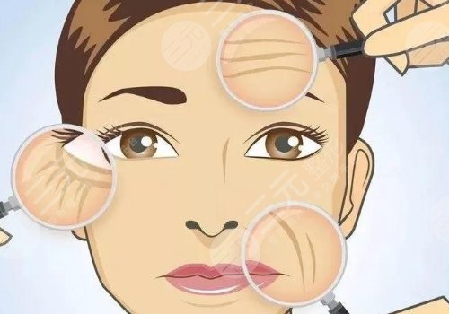 7d聚拉提美容的功效和副作用有哪些？