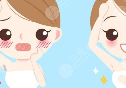 激光脫毛和冰點(diǎn)脫毛有什么區(qū)別？