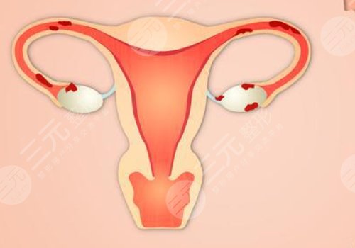 女性私處修復(fù)手術(shù)大概多少錢？