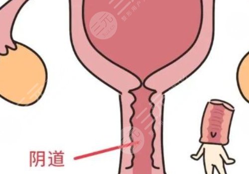 女性私處修復(fù)手術(shù)大概多少錢？