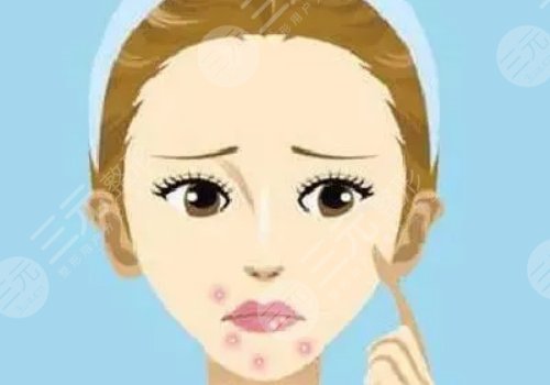 口周一直長(zhǎng)痘痘什么原因？